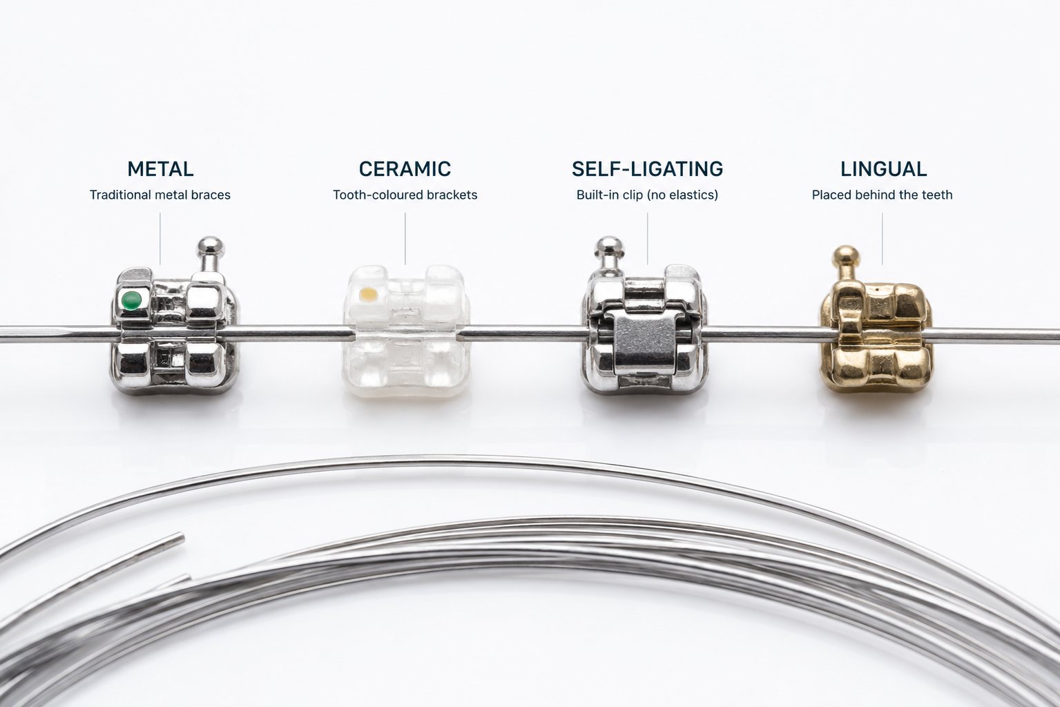 Metal, ceramic, self-ligating and lingual brackets on an archwire, labelled.
